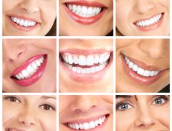 Beautiful Smiles Near Me Your Perfect Smile Awaits