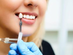 dentistry cosmetic near me Elevate Your Smile Today