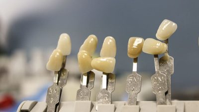 HD wallpaper: white artificial teetg, dentistry, dentals, teeth, model ...